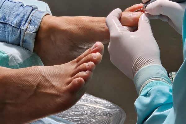 podologia_preventiva